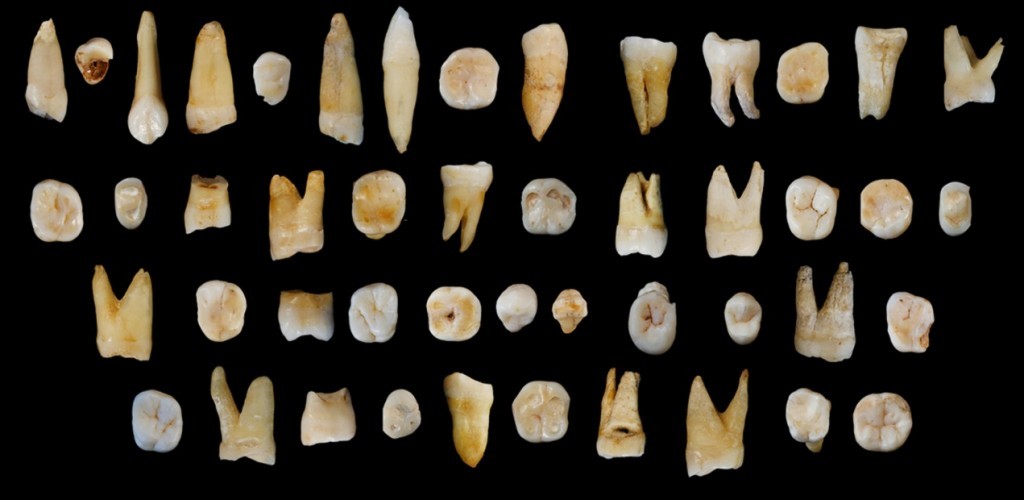 FOTO - A colecção de dentes fósseis agora descoberta na China S. XING E X. WU