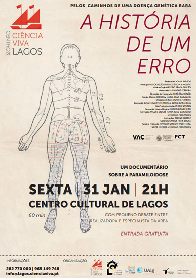 Sul Informação - Documentário sobre a “Doença dos Pezinhos” exibido no Centro Cultural de Lagos