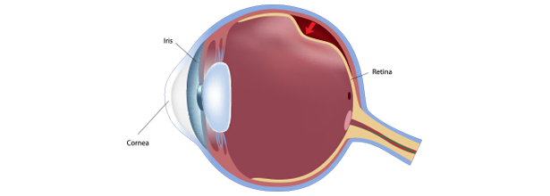 Sul Informação - Hospital Particular de Alvor realizou primeira vitrectomia por descolamento da retina
