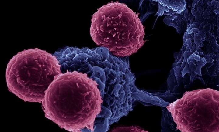 Sul Informação - Cientistas investigam novas vias para lutar contra o cancro