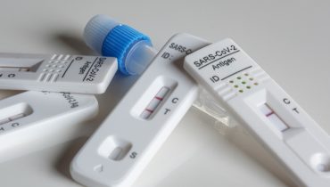 testes-covid-19-pandemia-coronavirus